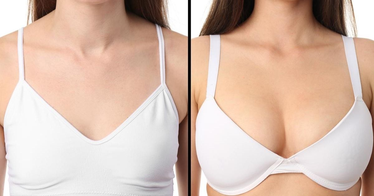Breast Augmentation in Dubai