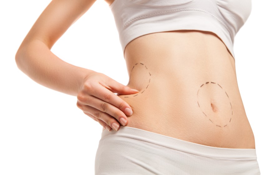 Fat Melting Injections