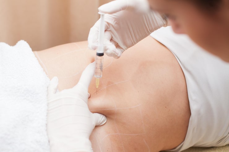 Fat Melting Injections