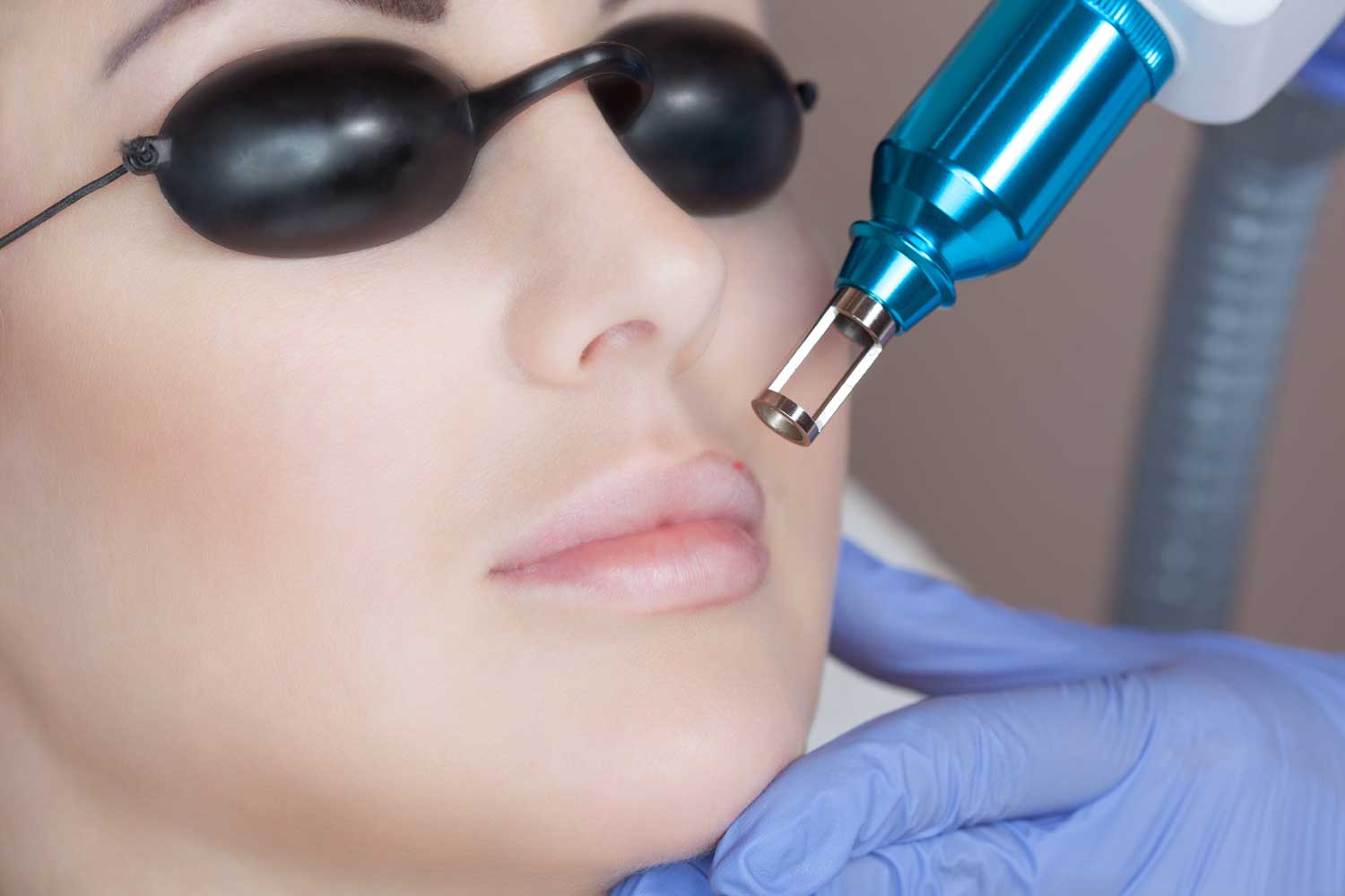 Pink Lips Laser Treatment